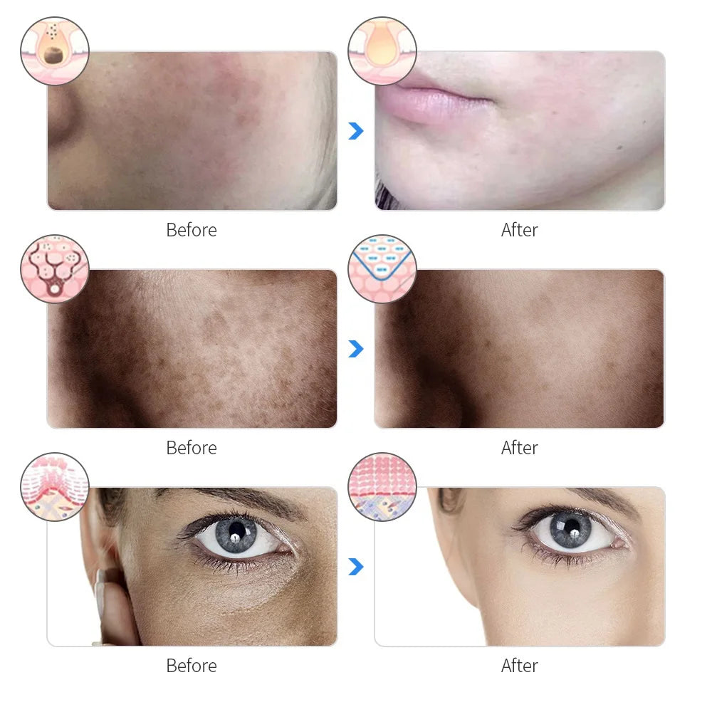 RadiantSkin Pro LED Facial Mask
